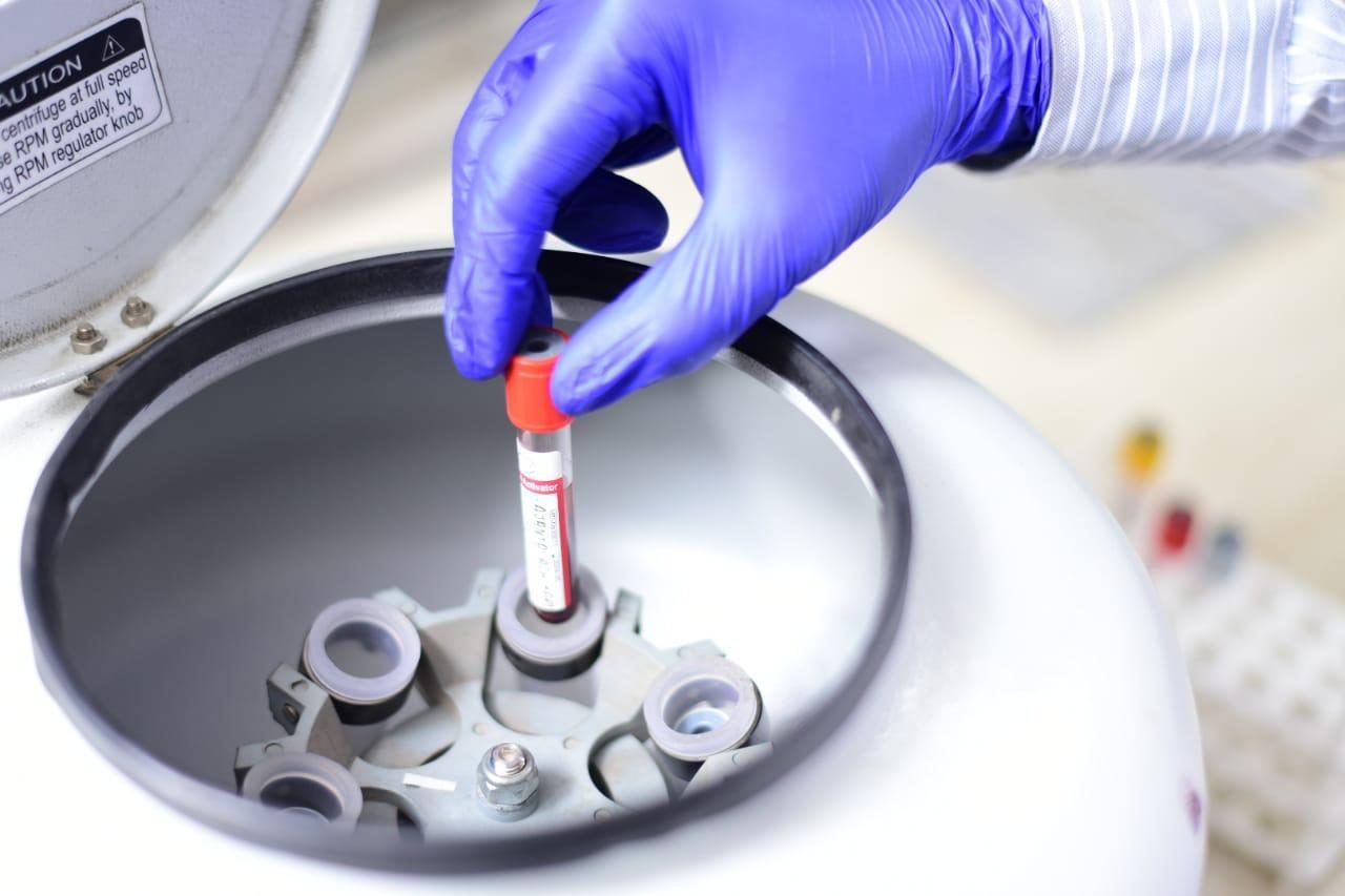 Full Body Health Checkup & Lab Tests in Guwahati: What You Need to Know
